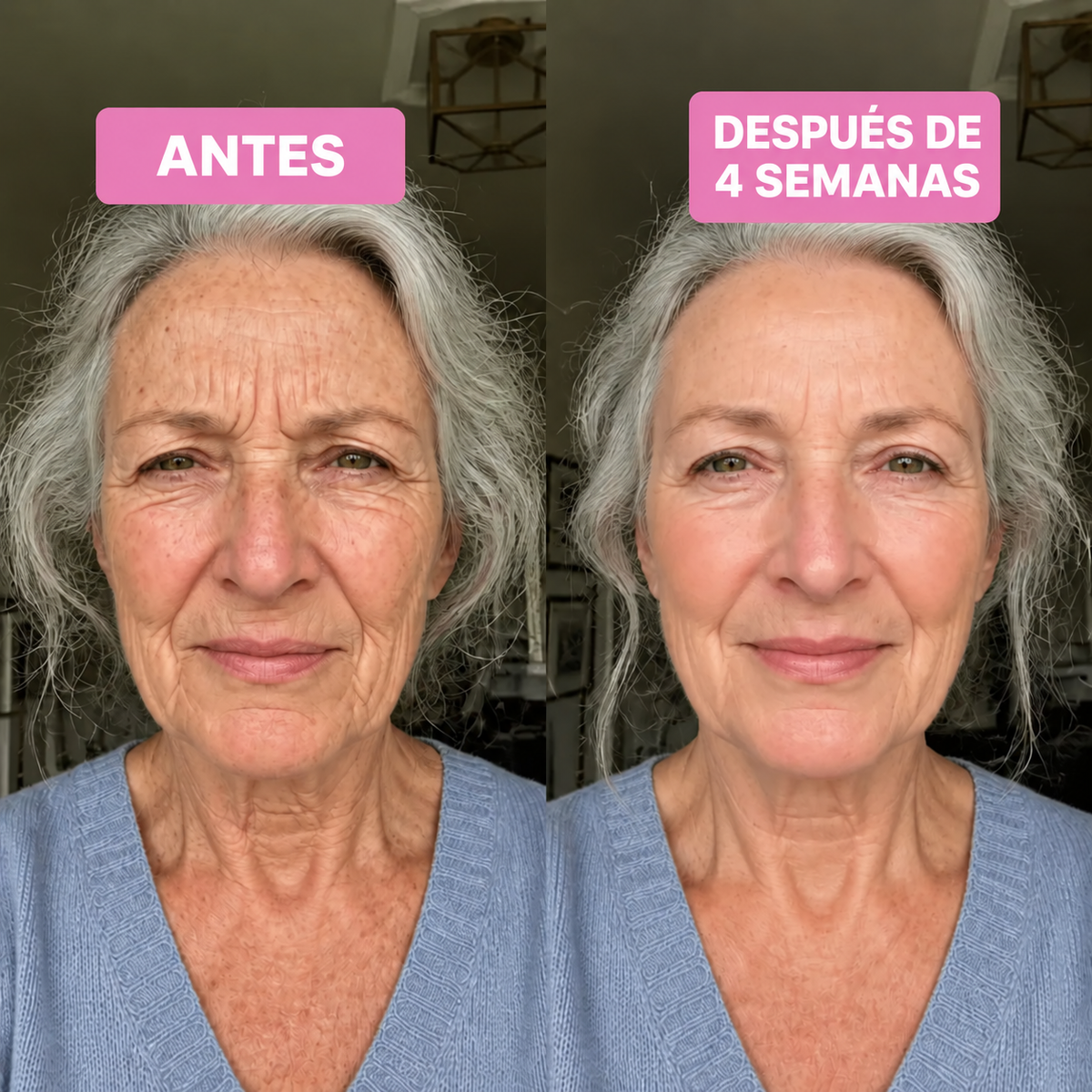 Avant / après — contour des yeux
