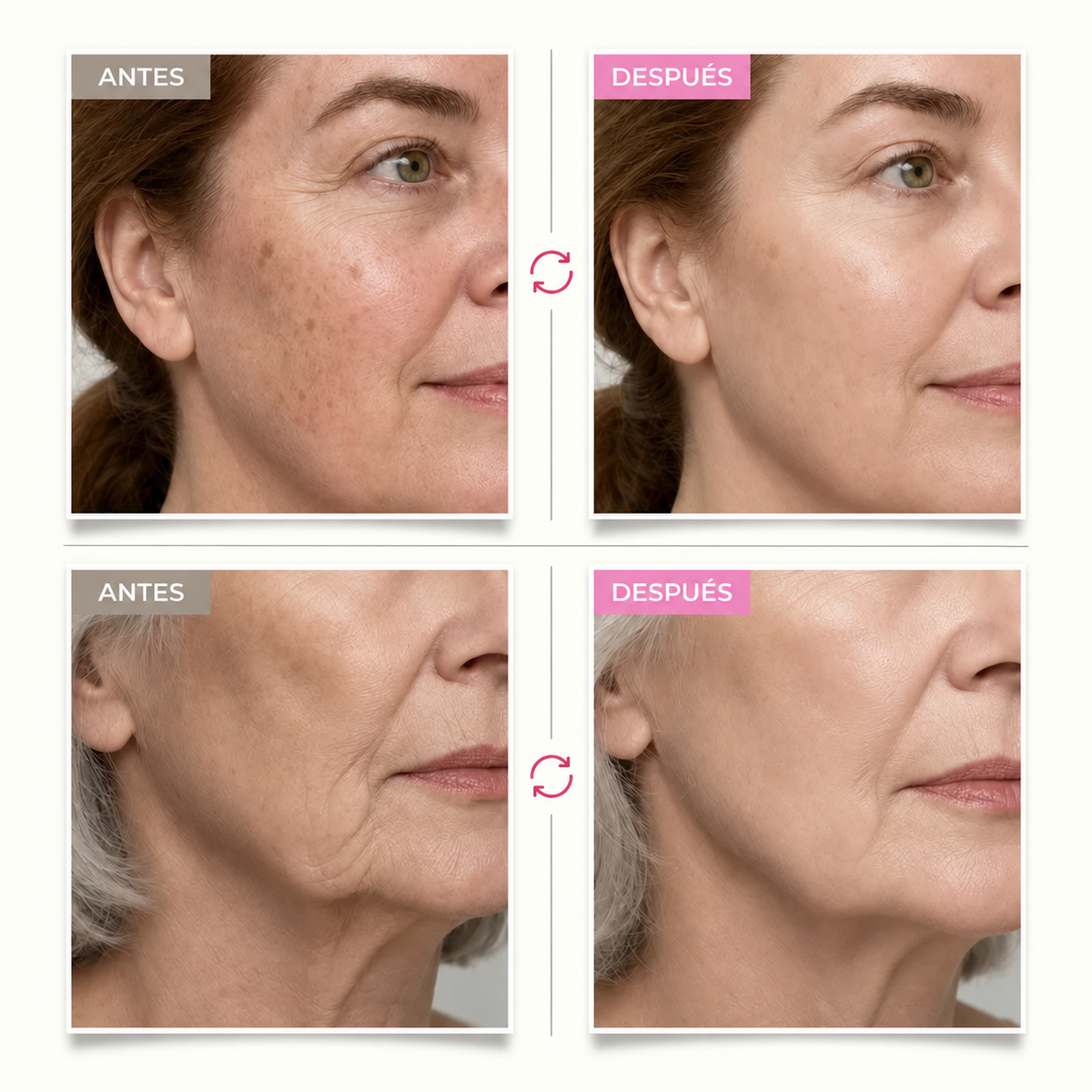 Grille avant / après — visage